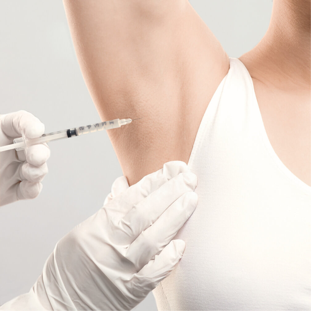 HofAesthetics - Praxis für ästhetische Medizin in Hof - Botox Hyperhidrose Behandlung gegen Schwitzen