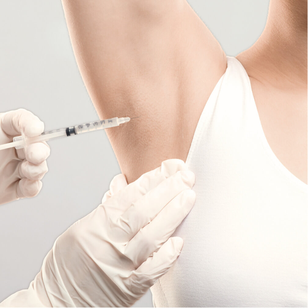 HofAesthetics - Praxis für ästhetische Medizin in Hof - Botox Hyperhidrose Behandlung gegen Schwitzen